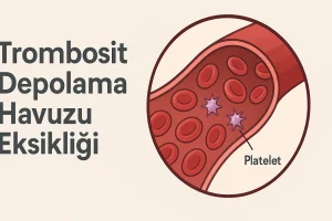Trombosit Depolama Havuzu Eksikliği (SPD): Hastalık Rehberi